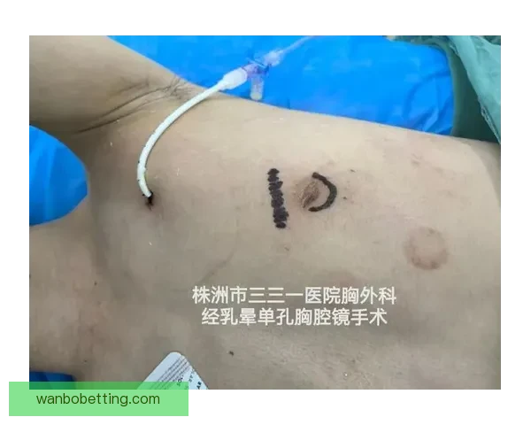 坎宁安气胸康复持续推进 活塞计划一周后复查评估